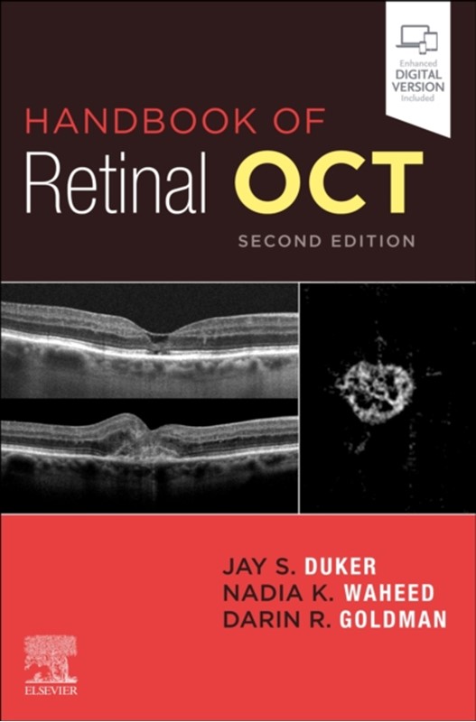 Handbook of Retinal OCT: Optical Coherence Tomography af Jay S. Duker ...